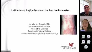 Urticaria and Angioedema Bernstein [upl. by Waldon]