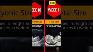 Pregnancy Week By Week  1  20 Weeks Fetal Developments  Ultrasound [upl. by Seigel]