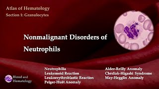 Nonmalignant Disorders of Neutrophils [upl. by Ervin284]