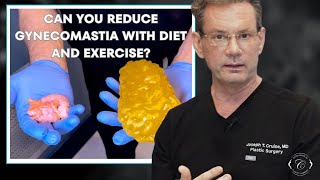 Gynecomastia Solutions Chest Exercises Diet amp Exercise [upl. by Nosmas331]