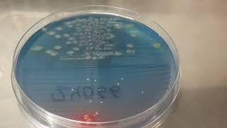 Colony characteristics of Pseudomonas aeruginosa on CLED Agar of Urine Culture [upl. by Brentt]