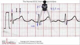 Interval Practice 65  ECG  EKG Interpretation  BASIC [upl. by Koralie377]