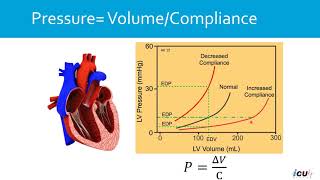 Why central venous presure measurement does not predict intravascular volume status accurately [upl. by Cirenoj808]