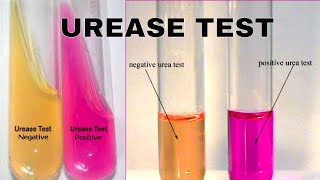 Urea Hydrolysis Urease Test [upl. by Ciel373]