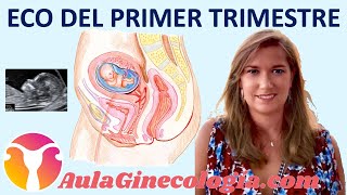 ECOGRAFÍA del PRIMER TRIMESTRE CROMOSOMOPATÍAS PREECLAMPSIA y más Ginecología y Obstetricia [upl. by Neyuq]