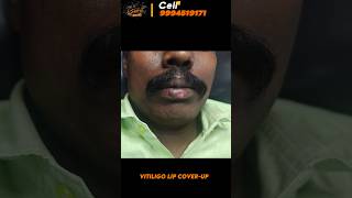 Vitiligo lips cover up  vitiligo treatment vitiligo lips vitiligo skin treatment trichy [upl. by Ailb]