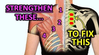 Strengthen These Muscles To Fix Rhomboid Pain [upl. by Lavona]