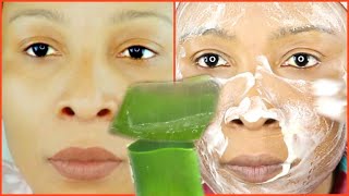 HOW I USE ALOE VERA TO GET RID OF WRINKLES AND CLEAR MY SKIN OF PIGMENTATION [upl. by Aprilette]