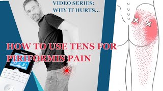 How to Use a TENS  EMS Muscle Stimulator To Fix Piriformis Muscle Syndrome [upl. by Turino]