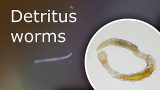 Detritus Worms What Is It and How to Get Rid of Them Detritus Worms Under a Microscope [upl. by Brandise813]