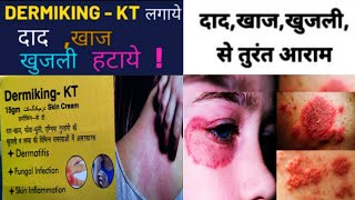 Dermiking kt skin cream  Use Of Dermiking KT Cream In Hindi  दाद खाज खुजली होगा अब जड़ से खत्म [upl. by Kcid]