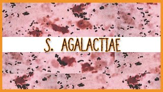 Streptococcus Agalactiae [upl. by Clarke]