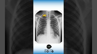 🔻 Anatomie VS Radiologie [upl. by Cosma]