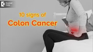 What are the 10 signs of colon cancer  Dr Rajasekhar M R [upl. by Annaeerb]