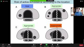 Risk Stratification in Differentiated Thyroid Cancer [upl. by Eanore]