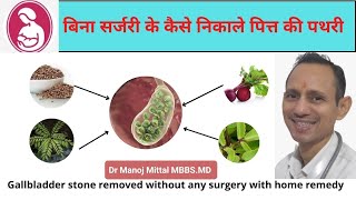 पित्त की थैली की पथरी बिना OPERATION कैसे ठीक करें घरेलू उपायHOME REMEDIES OF GALL BLADDER STONE [upl. by O'Driscoll]