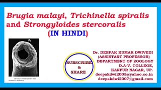 BRUGIA MALAYI TRICHINELLA SPIRALIS STRONGYLOIDES STERCORALIS IN HINDI [upl. by Eldrida]