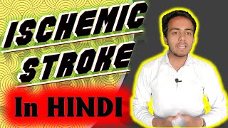 Ischemic Stroke इस्कीमिक स्ट्रोक ब्रेन स्ट्रोक Detailed In Hindi By SahilMittal MEP [upl. by Ayhay617]