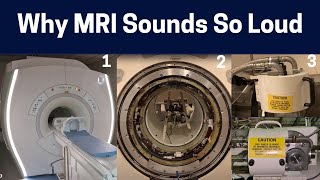 What Makes The Different MRI Scan Sounds Knocking to Rhythmic Chirping MRI Sounds Explained [upl. by Yona552]