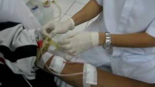 HEMODIALYSIS Procedure [upl. by Nolita]