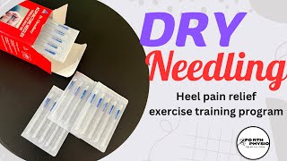 Dry needling therapy heel pain relief treatment [upl. by Dylane402]