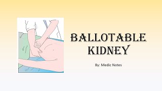 Ballotable kidney mechanism unilateral vs bilateral causes [upl. by Arlie]