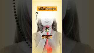 एसिड रिफ्लक्स के लक्षण  Acid Reflux ke Lakshan gerd gerdtreatment [upl. by Enaej]