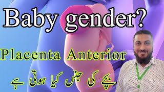 Placenta Anterior baby gender  placenta posterior baby gender  gender reveal  Dr Qazi F Shezad [upl. by Massingill]