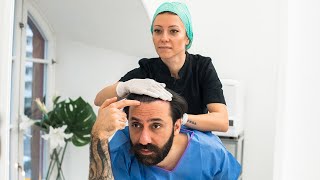 Hur går en hårtransplantation till  Nordic Hair® [upl. by Akcire]