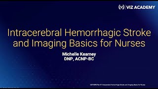 Intracerebral Hemorrhage Stroke and Imaging Basics for Nurses [upl. by Indira]