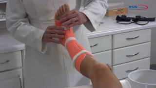 Synthetic Casting removable lower leg applicationENby BSN medicalmov [upl. by Boyes]