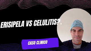 ERISIPELA VS CELULITIS [upl. by Rubenstein]