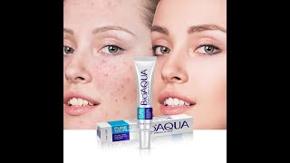 BIOAQUA Anti Acne Cream  Acne Scar Removal Cream  bioaqua acnetreatment acnescars pimple [upl. by Aicatsan]