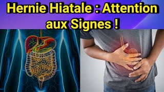 Hernie Hiatale  Symptômes Types et Traitements – Comprendre cette pathologie fréquente [upl. by Alekahs]