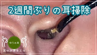 【耳かき】2週間ぶりの耳掃除【ear cleaning】 [upl. by Sidwell]