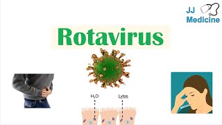 Rotavirus  Risk Factors Pathophysiology Symptoms Diagnosis Treatment [upl. by Otrebmuh668]