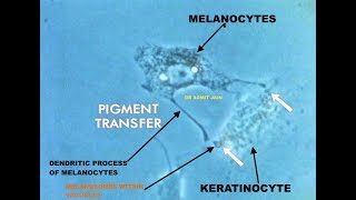 Pigment transfer in Skin cells Melanosome transfer from MELANOCYTE to KERATINOCYTE I Dr Somit Jain [upl. by Nnylyar]