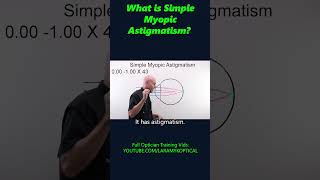 What is simple Myopic Astigmatism [upl. by Naerad]