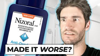 Nizoral Shampoo For Hair Loss  THE TRUTH [upl. by Azyl]