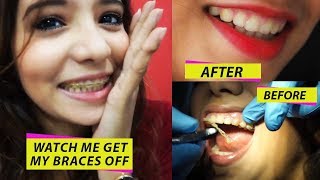 WATCH ME GET MY BRACES OFF amp THE DRASTIC CHANGE IN MY TEETH [upl. by Alfred]