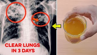 How to Remove Tar from Lungs After Smoking  Natural Recipe to Clear Lungs in 3 Days [upl. by Peisch]