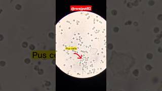 Urine of microscope exam 🔬 shorts [upl. by Gabie]