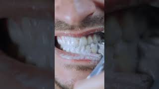 GARGLE the FILTHY Disgusting Teeth ASMR asmr asmrsounds [upl. by Blunt]