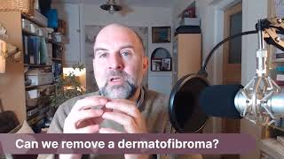 AskJJ Can we remove a dermatofibroma [upl. by Yojenitsirk]