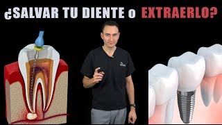 ENDODONCIAS VS IMPLANTES  ¿Es mejor salvar tu diente o extraerlo  Costos 2019 [upl. by Atal]