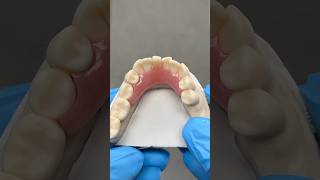 Lower Flipper Partial ​⁠EnvisiontecMain envisiontec lsk121shorts dentist teeth [upl. by Ivanah485]