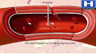 Blood clotting process hemostasis in 3D animation  Blood physiology [upl. by Lashond541]