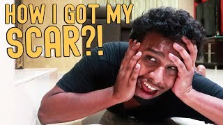 HOW I GOT MY SCAR [upl. by Abijah]