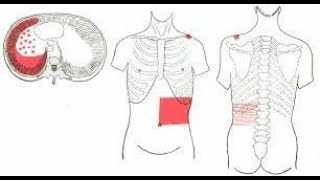 Why Pleurisy pain  Pleuritis pain is referred to the anterior abdominal wall [upl. by Ettennig814]