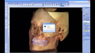 Quick launch 3D volume with 3D photo and impression scans from Planmeca Romexis® to Dolphin Imaging [upl. by Sauls]